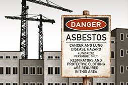 Asbestos Lung Cancer